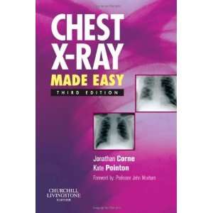   Ray Made Easy, 3e [Paperback] Jonathan Corne MA PhD FRCP Books