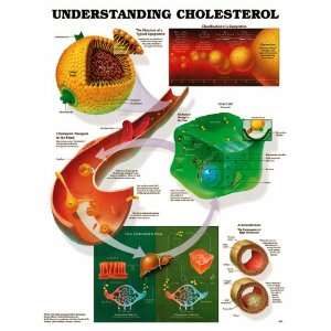 Understanding Cholesterol Anatomical Chart Paper Unmounted:  