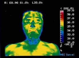 New Tourmaline Far Infrared Ray Heat Health Neck Brace Support Strap 