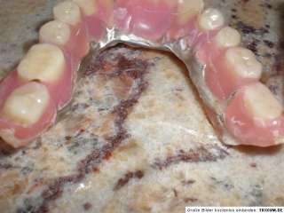 Zahnersatz Zahnprothese Gebiss Zähne Dental ♥ UNIKAT♥  